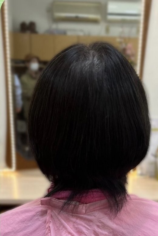 施術後