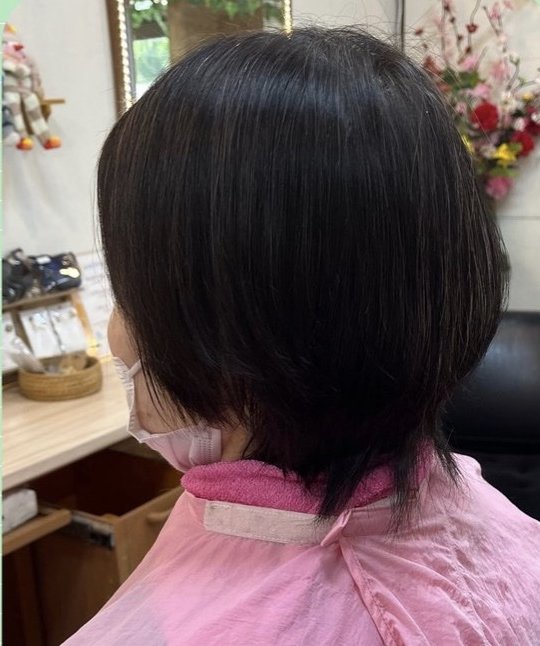 施術後